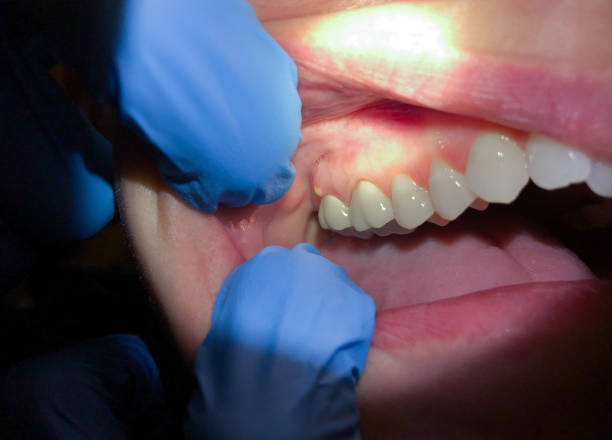 Best Emergency Treatment for Jaw Pain or Injury in Howard Lake, MN